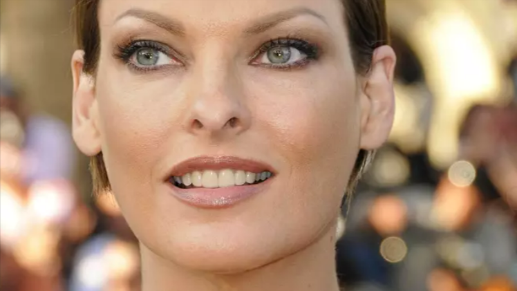 Krebs-Drama um Supermodel Linda Evangelista! Sie lies sich beide Brüste amputieren